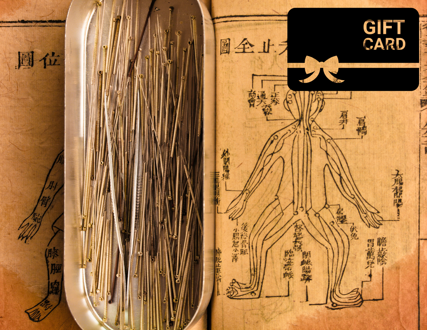 Acupuncture Treatment Gift Card